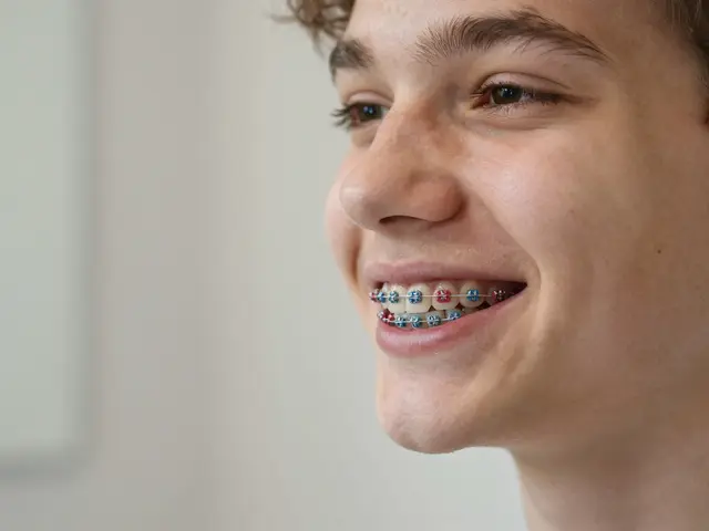 Na co jsou gumičky na rovnátka? Vše, co potřebujete vědět o jejich funkci a důležitosti