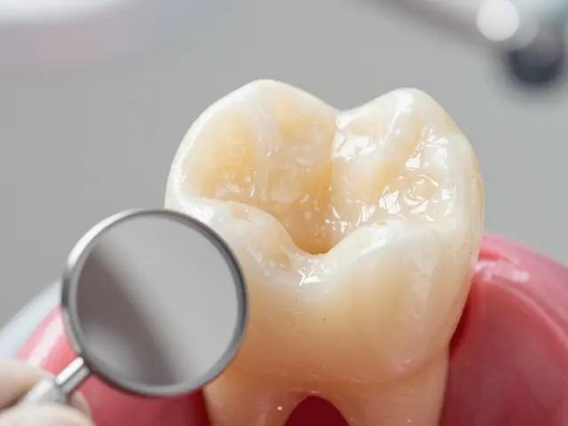 Zubní eroze: Proč fazety nejsou řešením a jak léčit skutečně