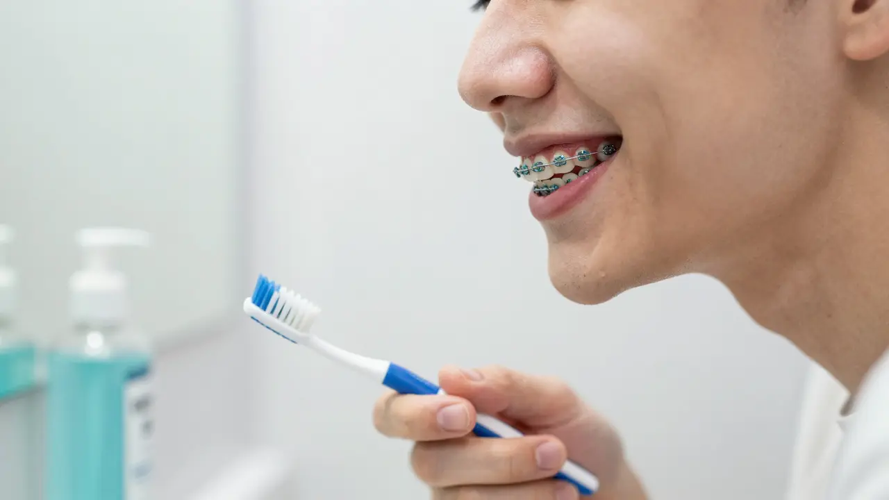 Fazety na křivé zuby: Co očekávat po zákroku