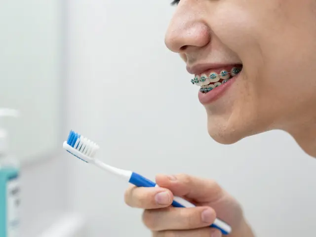 Fazety na křivé zuby: Co očekávat po zákroku