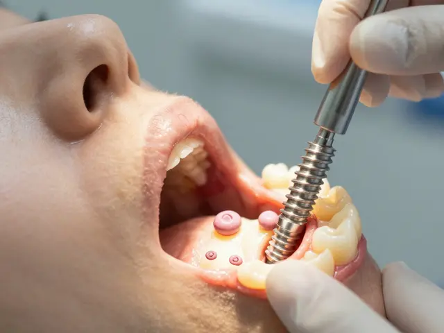 Jak dlouho se hojí zubní implantáty? Všechno, co potřebujete vědět