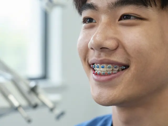 Jak vypadají fixní rovnátka? Všechno, co potřebujete vědět o vzhledu a fungování trvalých ortodontických aparátů