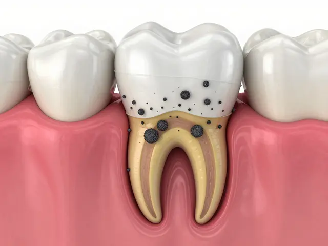 Jak probíhá kyretáž zubů: Průvodce zákrokem a hojením
