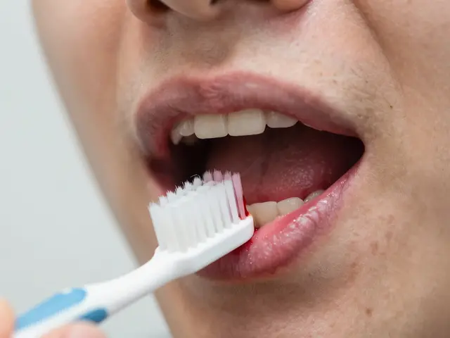 Jak se projevuje parodontóza: Příznaky, příčiny a cesta k záchraně zubů