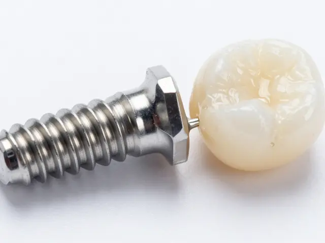 Zubní implantáty: Průvodce výběrem a co očekávat od moderní stomatologie